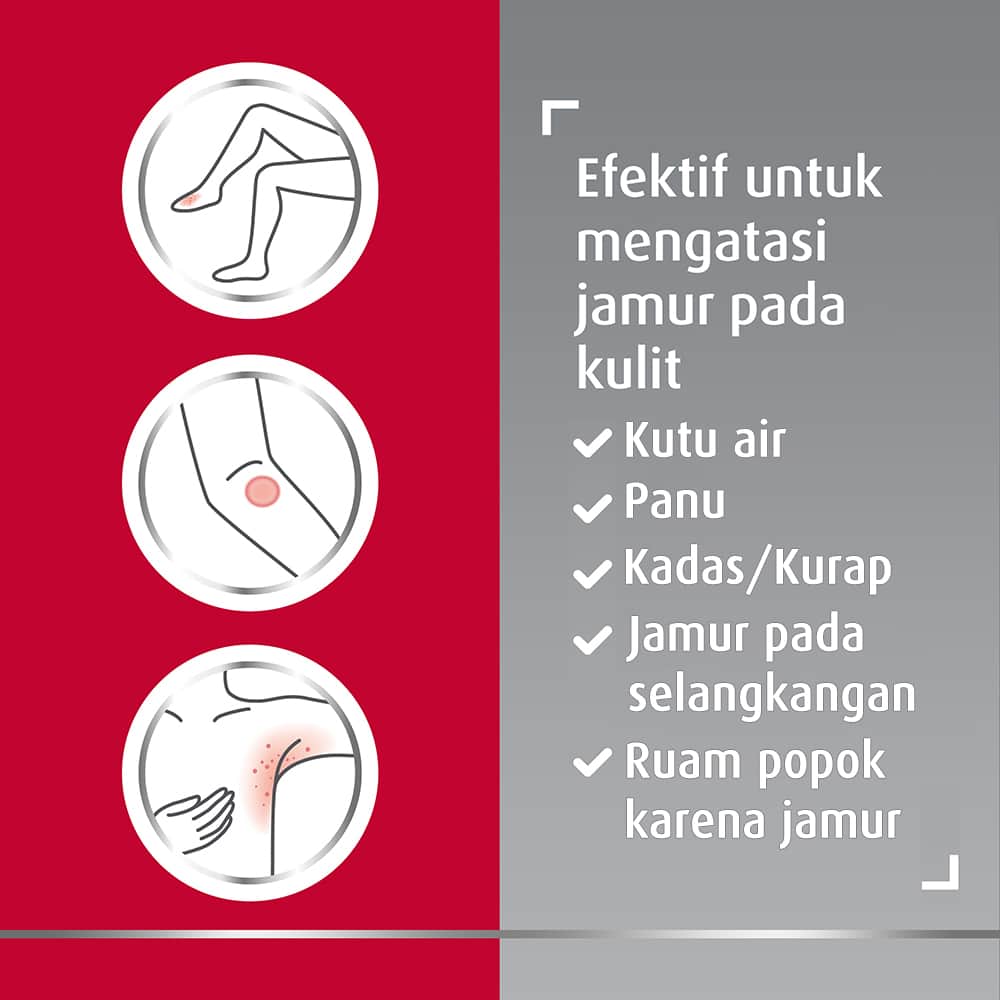 Krim Canesten Klotrimazol 1% | Obat Anti Jamur